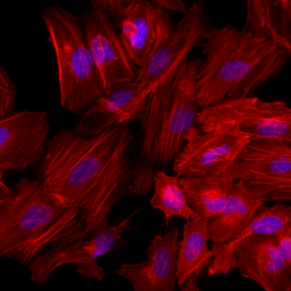 TRITC Phalloidin標(biāo)記鬼筆環(huán)肽  Actin-Tracker Red-Rhodamine (微絲紅色熒光探針)