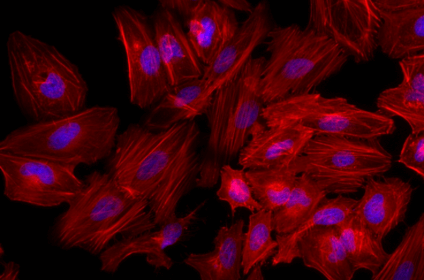 TRITC Phalloidin標(biāo)記鬼筆環(huán)肽  Actin-Tracker Red-Rhodamine (微絲紅色熒光探針)